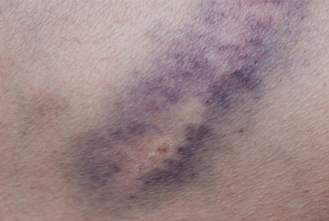 教你辨别_患者_皮肤_食物