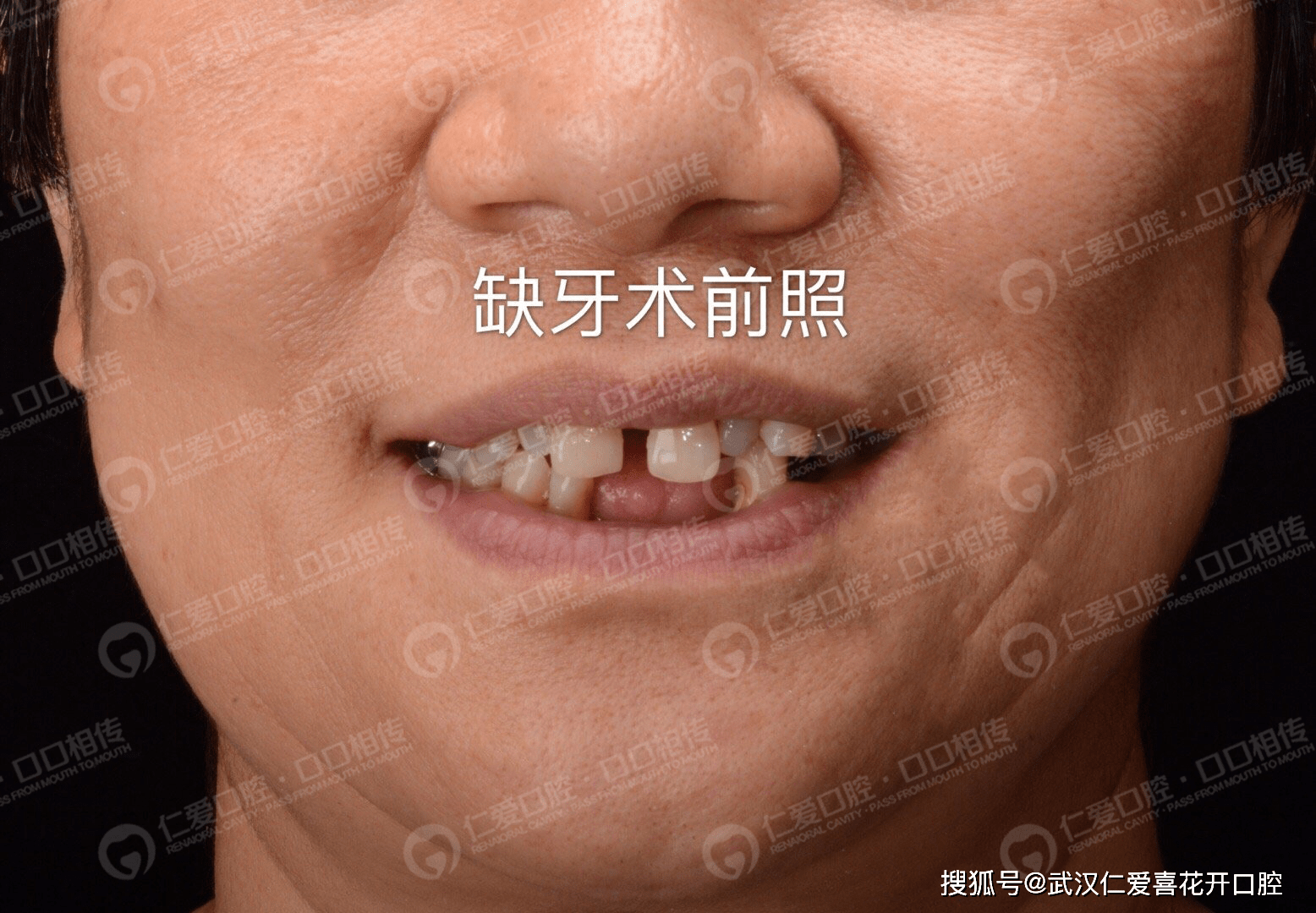 91e028c66cea47a3b43ab41302c2c7c6.png