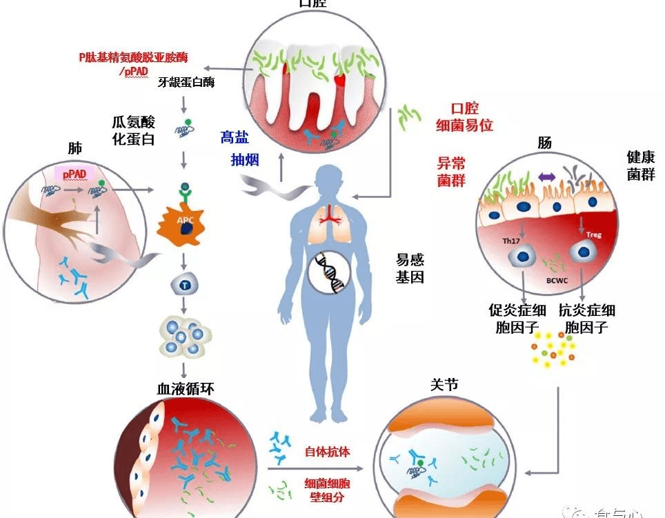 甲状腺|肠漏，你必须知道的热知识（二）