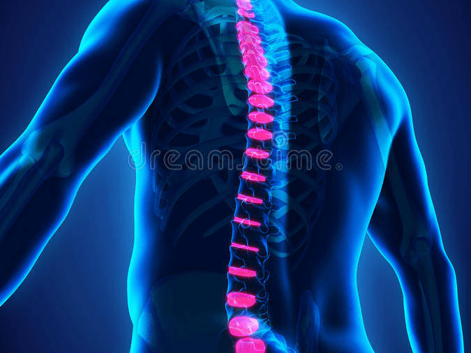 腰痛患者的希望 干细胞移植改善椎间盘源性腰痛效果良好 治疗 病例 研究