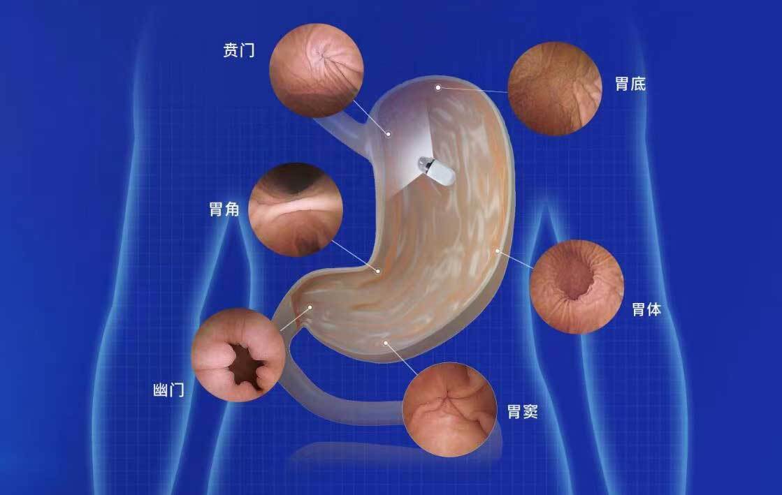 检查|春季胃病多发，“胃”你还好吗？医生有话说！