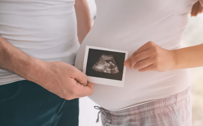 怀孕6周b超图片真实图片