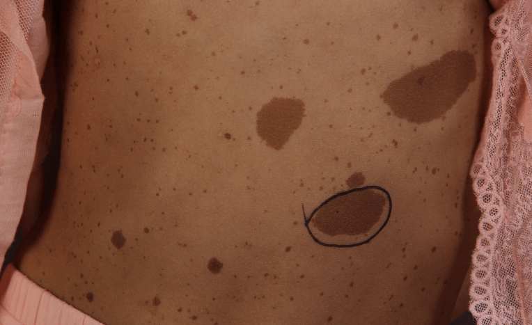 疾病_神经_宝宝