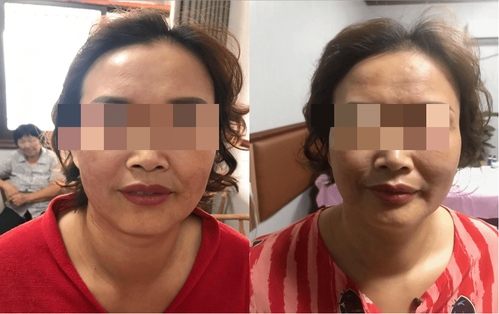 拜克漾拜克漾速美素蝮蛇毒肽复合物W丨深层滋养，美白嫩肤
