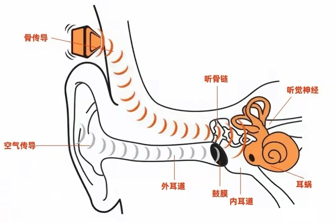 骨传导耳机是什么原理骨传导耳机与入耳式耳机的区别