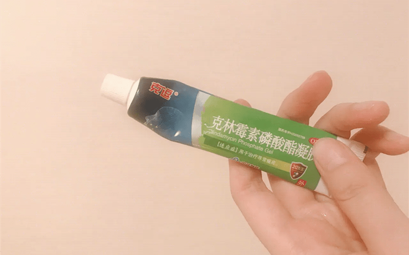 机理关于祛痘药膏，你至少要知道这5款！