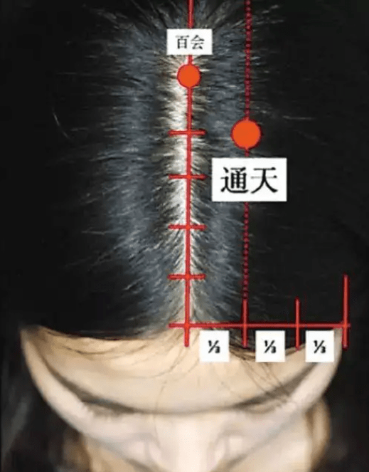 菏澤李傳紅遞愛康五行八卦脈法針灸_穴位_主治_文化