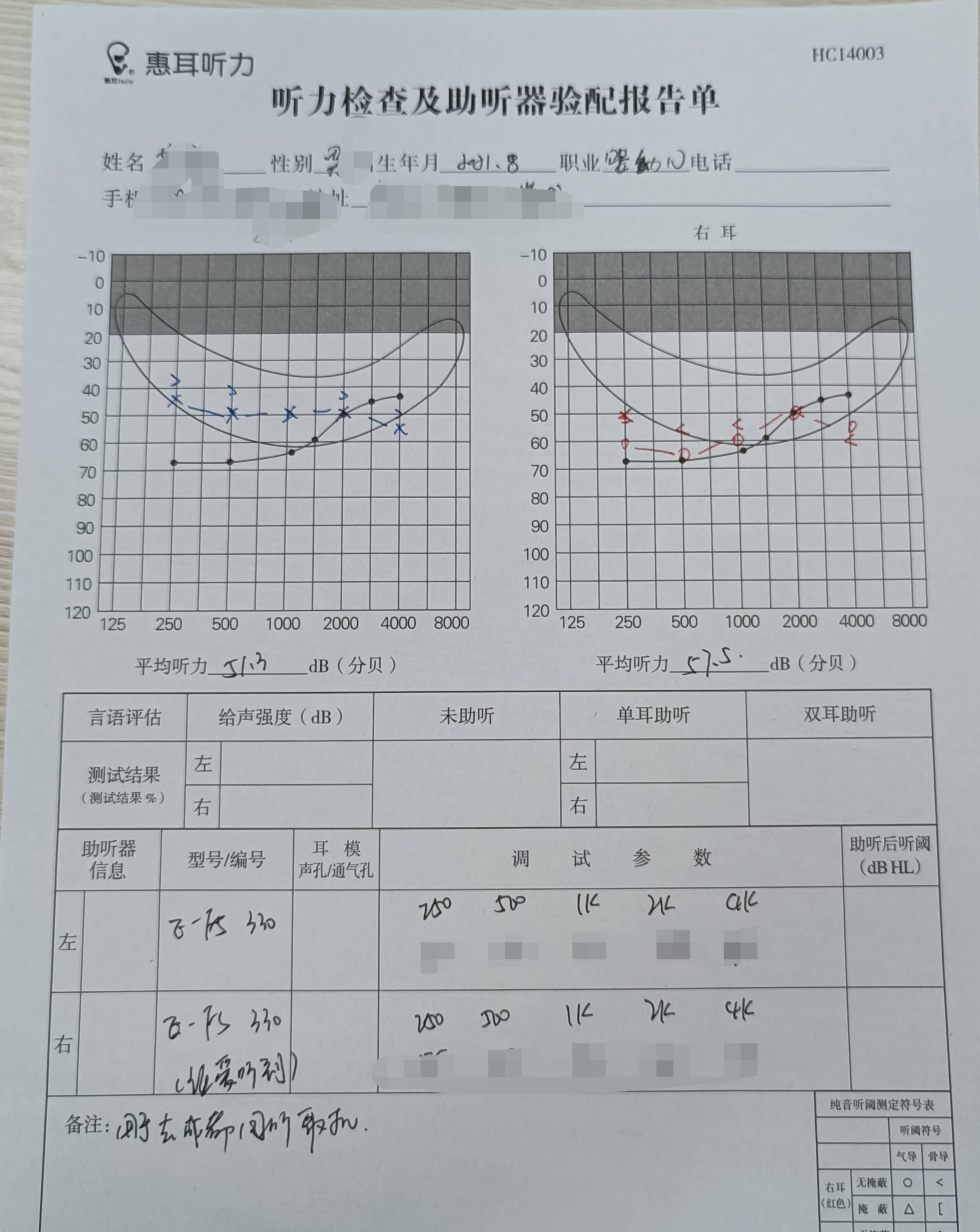 听力检查报告正常图片图片