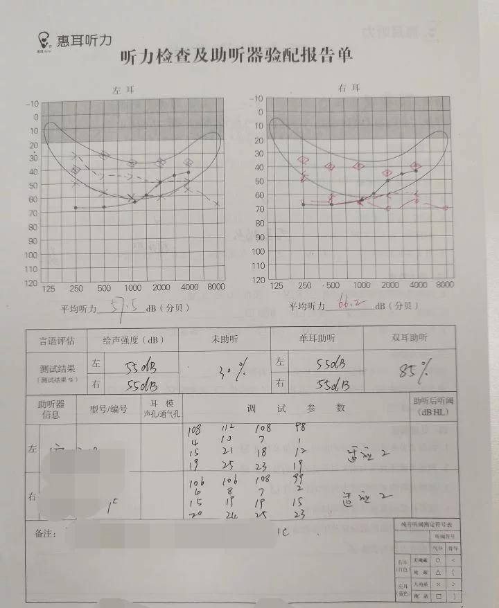 耳廓及外耳道無畸形二,聽力檢查純音聽力檢查報告如下:4.