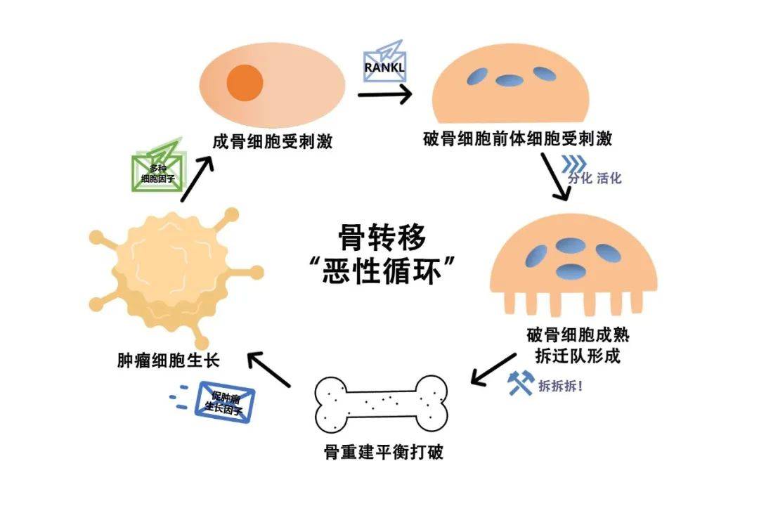 癌症发生骨转移了,治疗还有意义吗