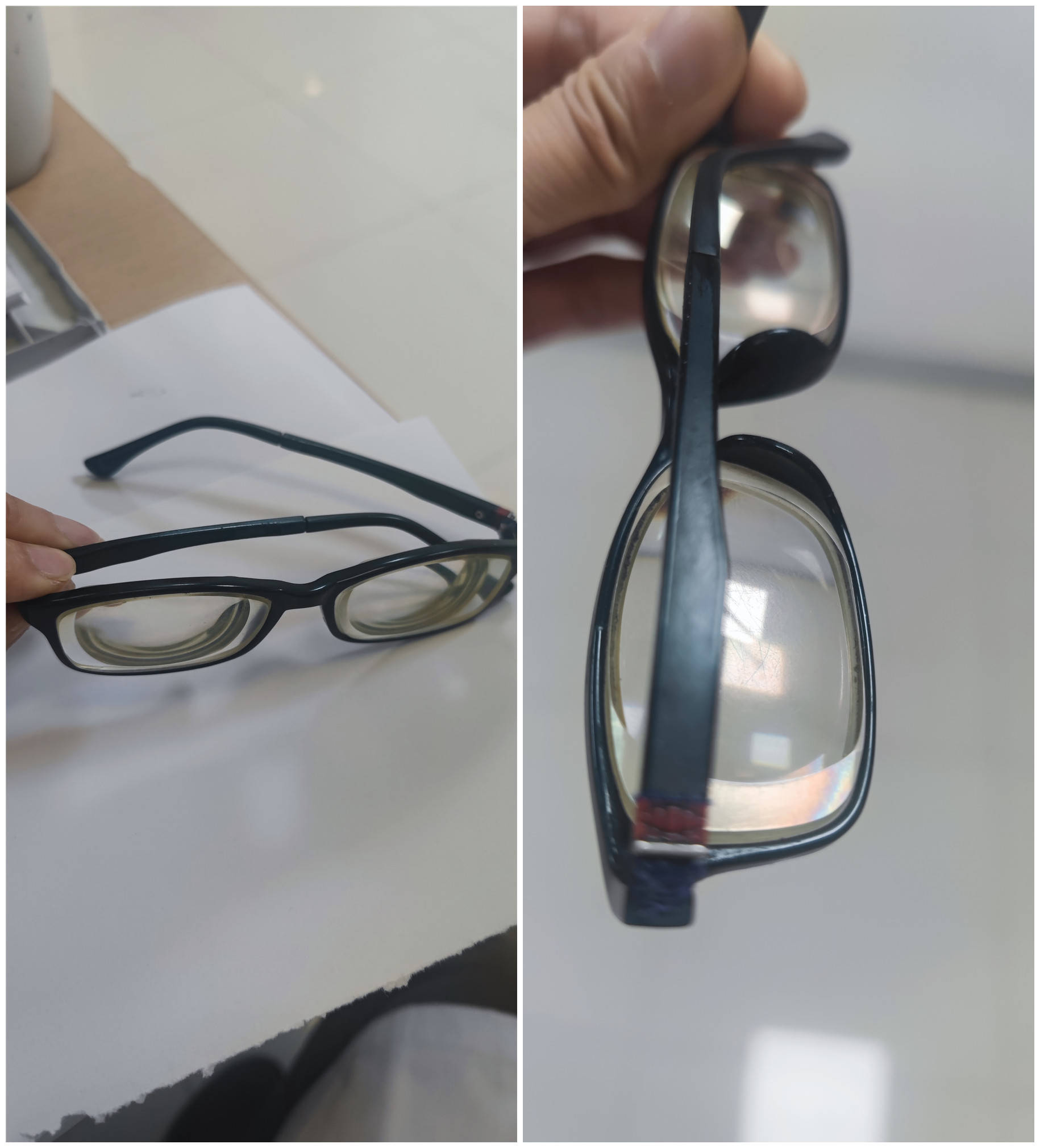 52岁超高度近视2400度,佛山华厦眼科张晓山院长妙手回春助其重见光明!