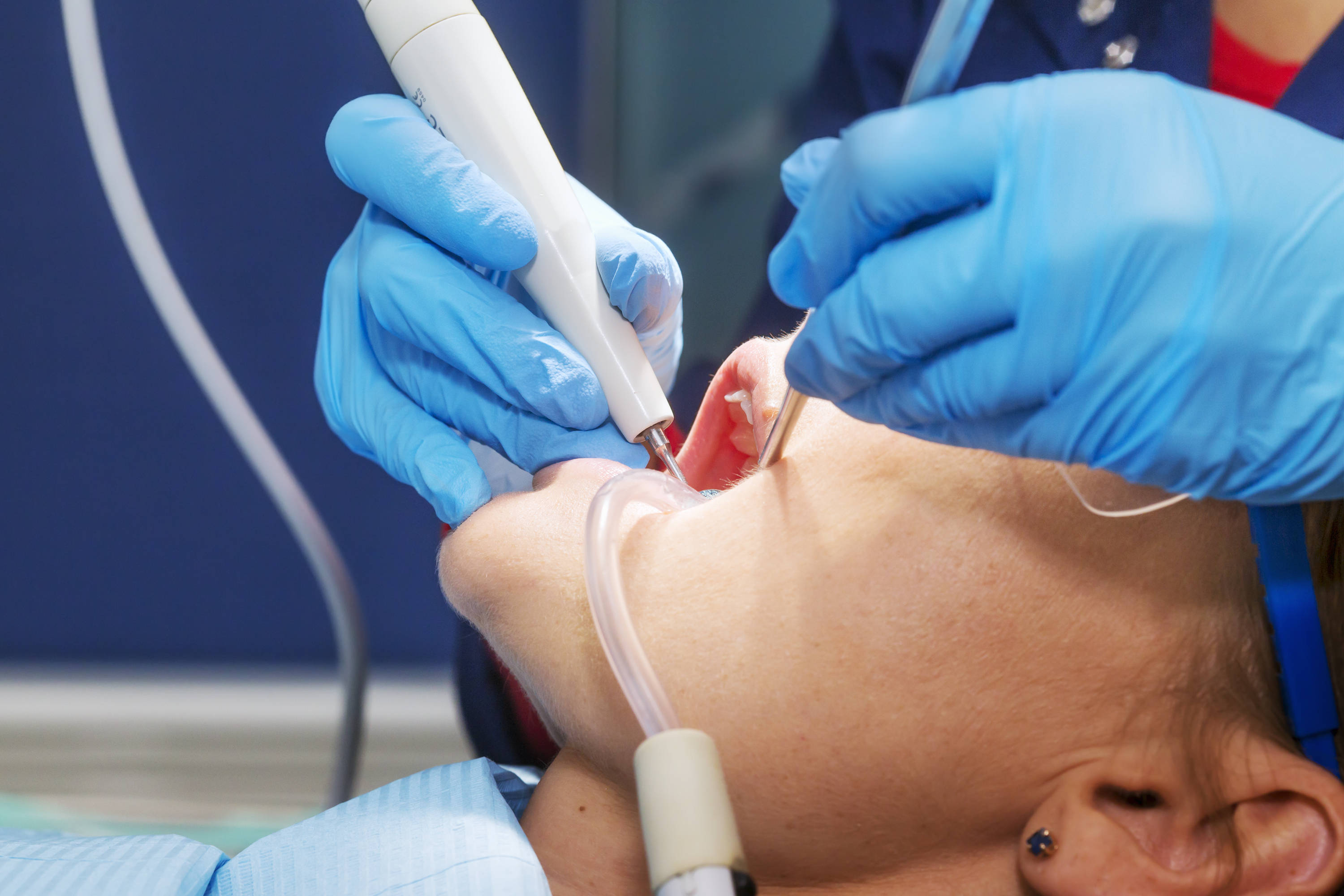 进行_牙齿_治疗