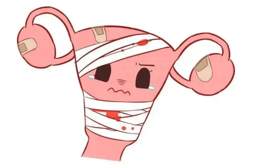 流产后不孕该怎么办?_子宫_内膜_女性