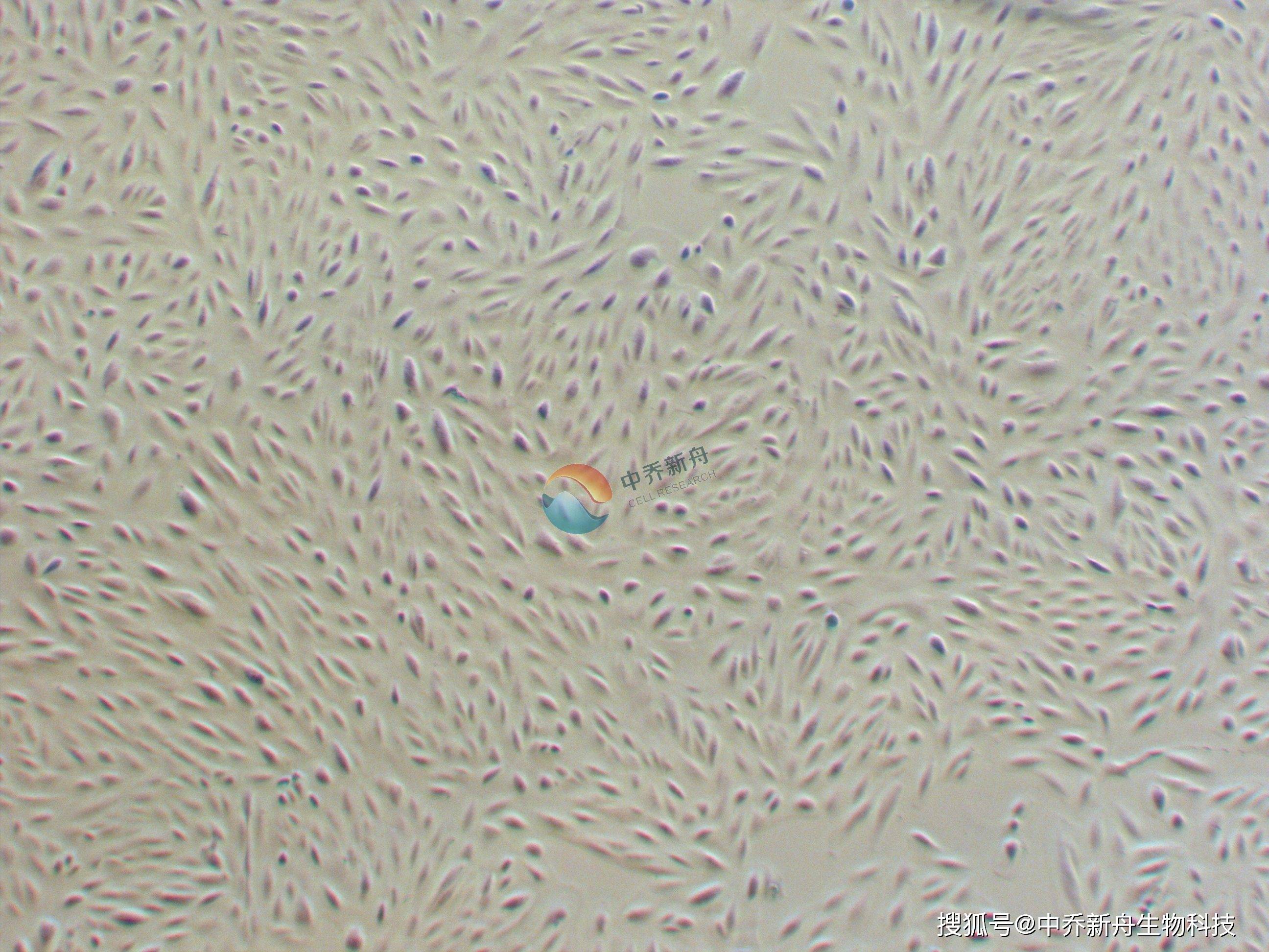 细胞角蛋白19片段图片