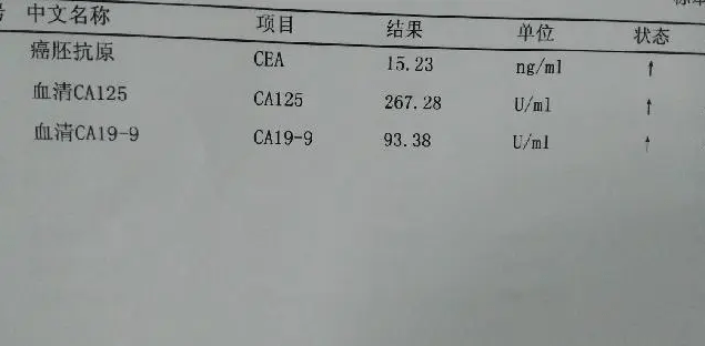 癌胚抗原升到多高是肿瘤?