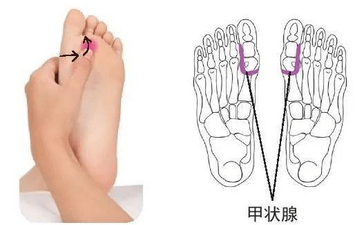 关于甲状腺足底反射区的说明定位:双脚脚底拇趾与第二趾蹼处沿第一