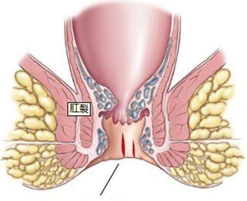 肛门_严重_调节