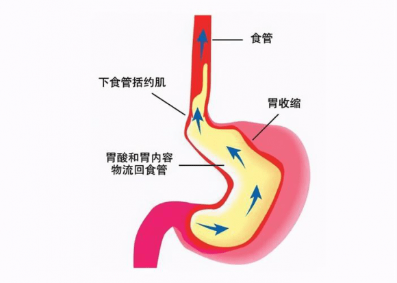 贵阳微创胃肠专科医院 饭后烧心难忍