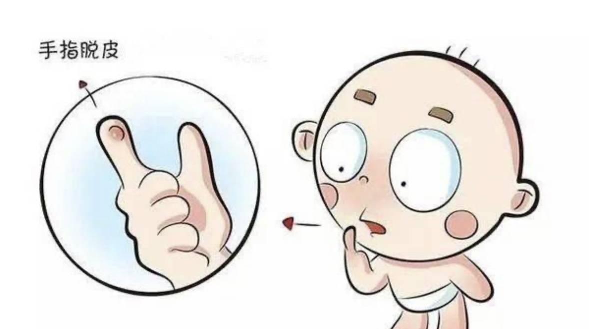宝宝手指脱皮？家长看过来！
