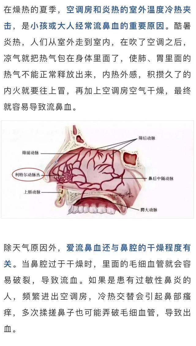 健康流鼻血要仰头错正确的处理方式是