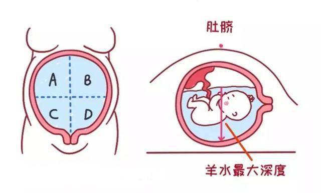 羊水为什么要叫羊水