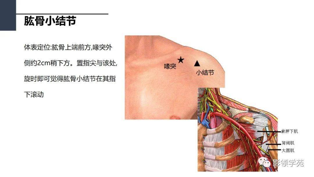 肩關節解剖及常見疾病影像表現