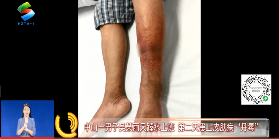 脱了鞋蹚水赶路,到公司后因为没有备用鞋袜,只能穿着湿袜子,鞋子继续