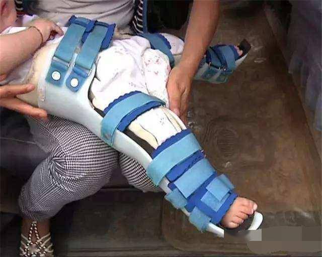 熊孩子爬邻居家里偷桃吃却摔断双腿孩子家长必须赔偿医药费