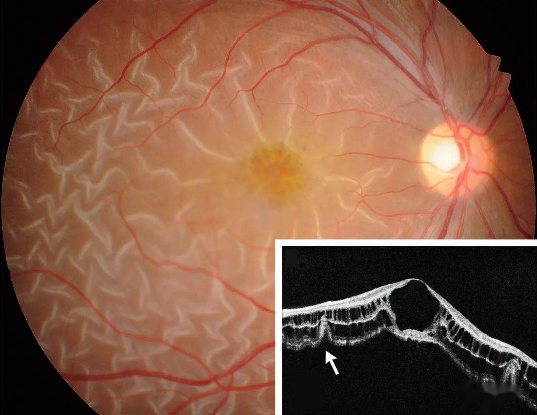 胸廓外伤|协和八·每日一题