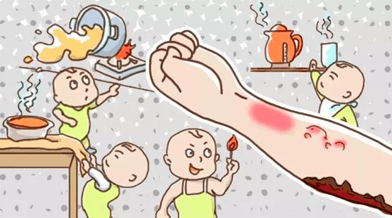 【健康宝贝】儿童烧伤,烫伤时该怎么办?家长老师都该看看