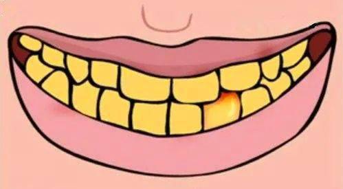 哪里有勇气张口尬笑啊一张嘴就是一口黄牙和口气牙