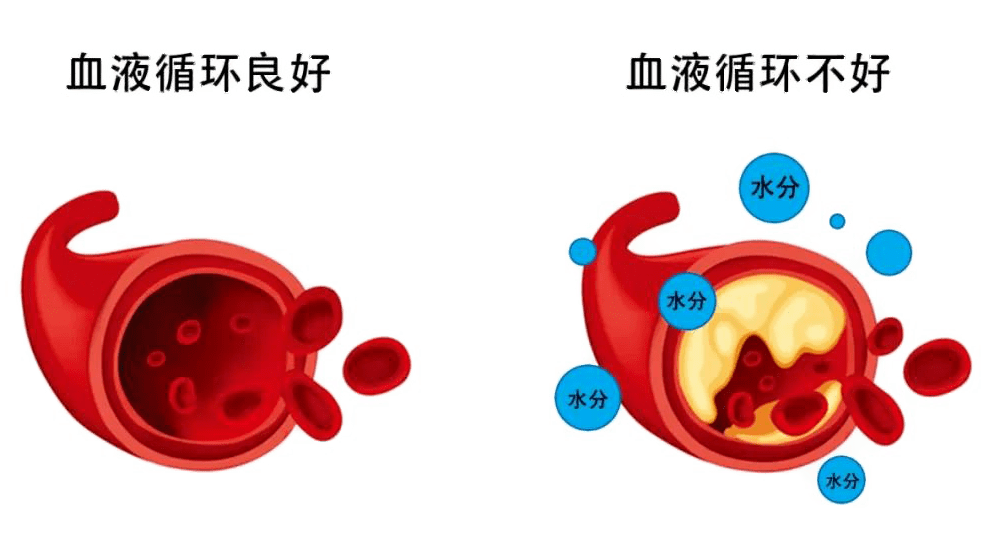 当血液循环良好时,体内水分会随着血管不停流走,使身体保持着水分平衡