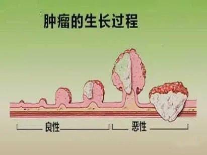 为何肿瘤怕艾灸一灸补阳二灸化阴三灸强免疫