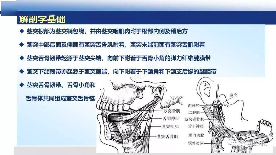 茎突综合征影像诊断