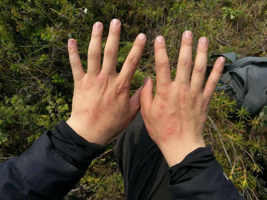 暖警心 大林公安局党委慰问一线公安民警_手机搜狐网