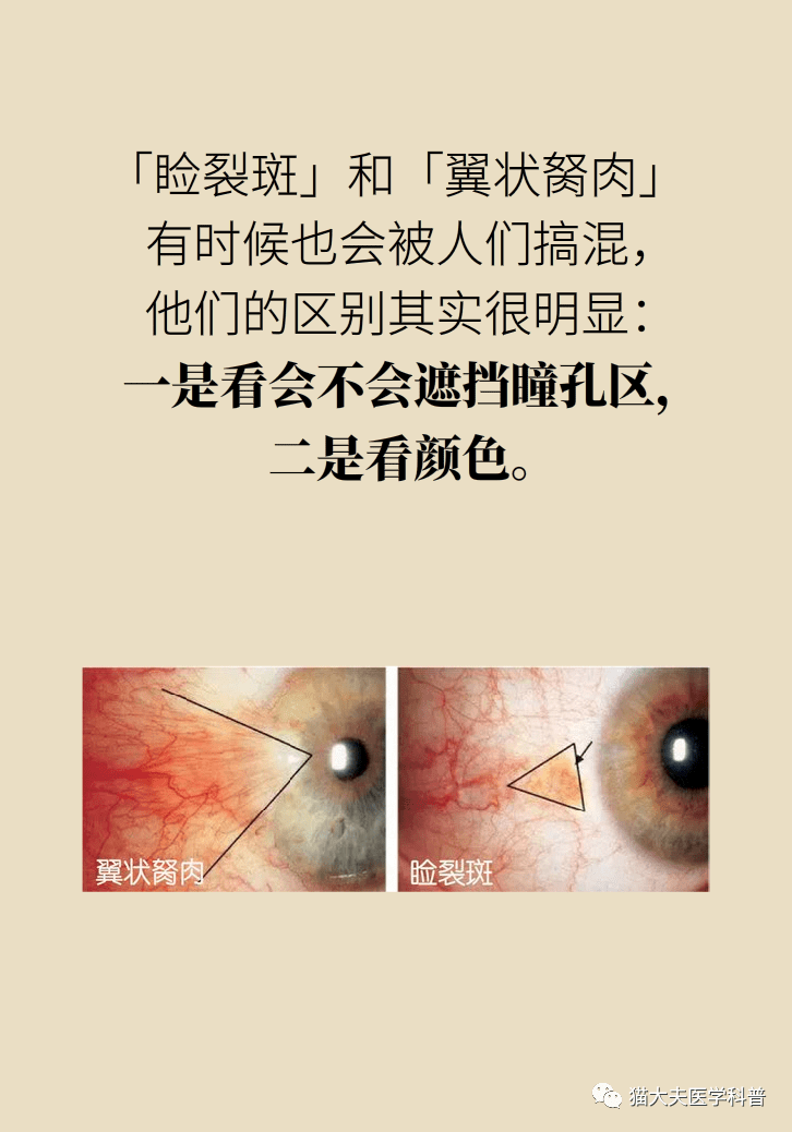 同仁专家:这3种眼病名字唬人,其实问题不大!