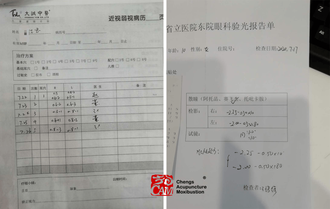 青岛大诚中医门诊部梅花针耳穴治疗近视病例分析