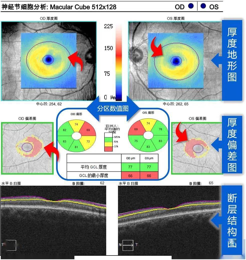 每周最佳病例分享 | 视神经炎-搜狐大视野-搜狐新闻