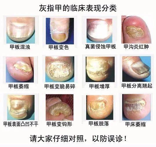 科普:皮肤是人类最大的器官 但皮肤病的种类及危害你了解多少?