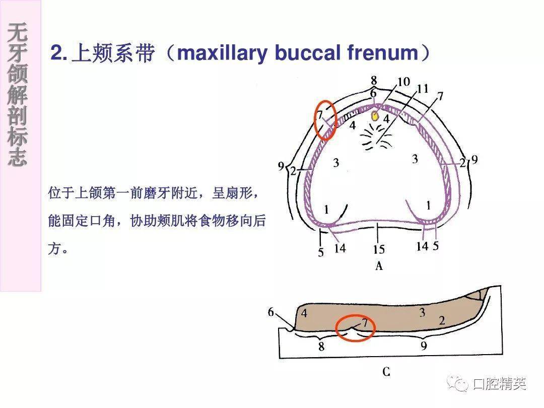 无牙颌解剖标志