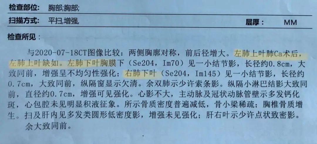 在術後複查時,再次發現雙下肺小結節影,擬行雙下肺肺段或楔形切除