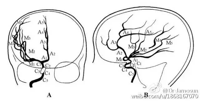 后交通动脉,脉络膜前动脉,末端分出大脑前动脉和大脑中动脉(图7～图9)