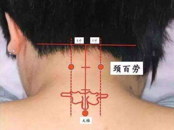 为什么脖子一转就响脖子咔咔响当心经络闭阻引发重症艾灸调理这样做