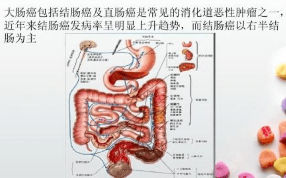 近期出現排便習慣改變,持續腹部隱痛.