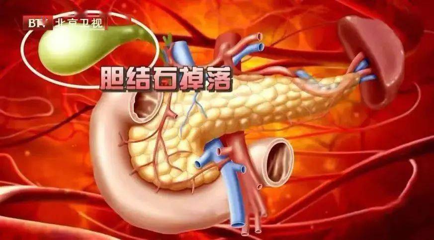 另外,若不进食,胆汁长时间停留在胆囊内,过分浓缩后容易析出结晶,长期