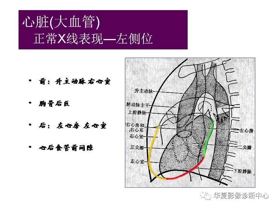 心脏大血管的影像解剖