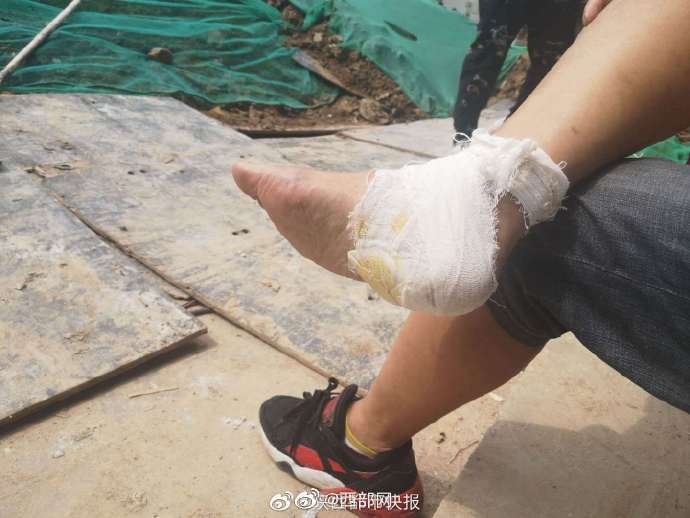 小区施工铺设木板方便出行 男子被裸露钉子扎破脚后跟