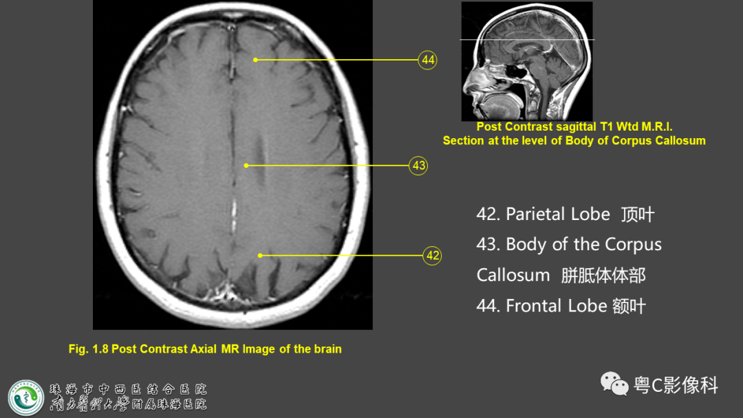 影像解剖影像技术颅脑mri平扫扫描方案