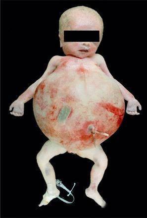 比寄生虫更惊悚的是寄生的人类_胎儿