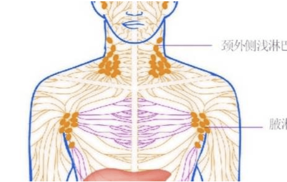 颈部痰核症状图片图片